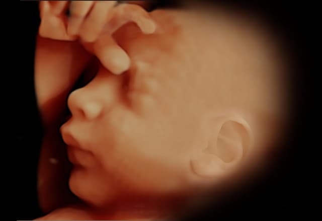 Tecnología avanzada que permite visualizar imágenes en tiempo real y en alta definición del feto, mostrando movimientos y rasgos faciales con gran detalle.